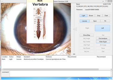 Ιατρική συσκευή ανάλυσης της Iris ματιών ψηφιακών κάμερα Megapixel πεδίου 12.0MP USB Iris