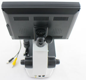 Επαγγελματικό μικροσκόπιο μικροκυκλοφορίατος/Nailfold τριχοειδής μικροσκόπηση με τα βιντεοκάμερα CCD