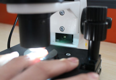 Ακριβής Nailfold χρώματος LCD τριχοειδής συσκευή μικροσκοπίων μικροκυκλοφορίατος για τον υπο- έλεγχο υγείας