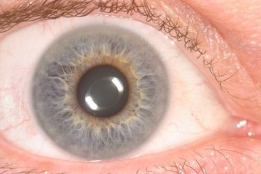 Η φορητή συσκευή ανάλυσης ανιχνευτών της Iris ματιών CE φορητή για την υγεία ανιχνεύει