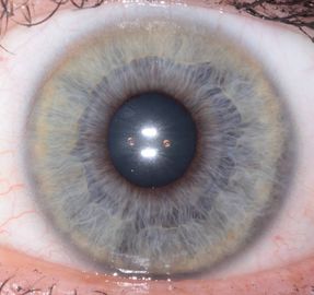 Η φορητή συσκευή ανάλυσης ανιχνευτών της Iris ματιών CE φορητή για την υγεία ανιχνεύει