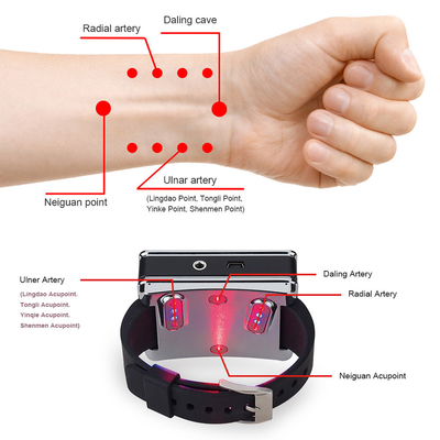 Θεραπεία Wristwatch, χαμηλό υπέρυθρο φως κόκκινου φωτός βελονισμού έντασης για την ανακούφιση πόνου ρινίτιδας σώματος ώμων γονάτων