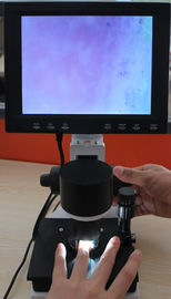 Nailfold χρώματος τριχοειδές μικροσκόπιο 380000 εξοπλισμού μικροκυκλοφορίατος εικονοκύτταρα με το CE