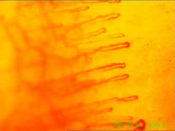 Τριχοειδές μικροσκόπιο αίματος για την ανίχνευση της υγείας σώματος, εξουσιοδότηση 1 έτους